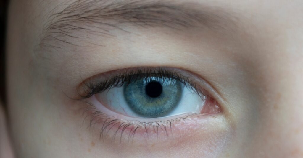 Lupus Eye Complications