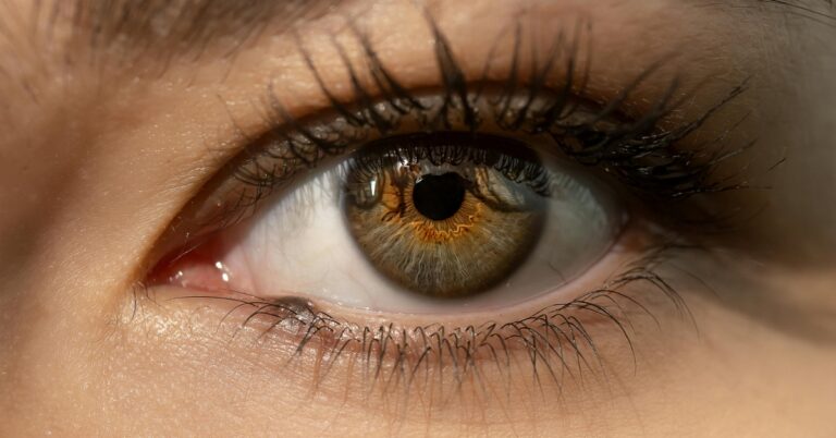 Severe Dry Eye
